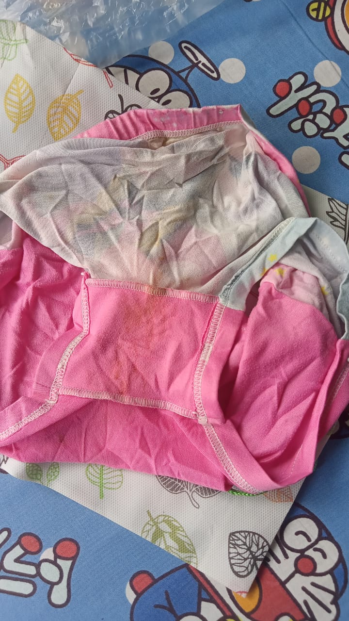 celana bunga usai mengalami rudapaksa